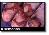 Foto de um aborto - 8 semanas