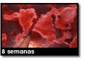 Foto de um aborto - 8 semanas